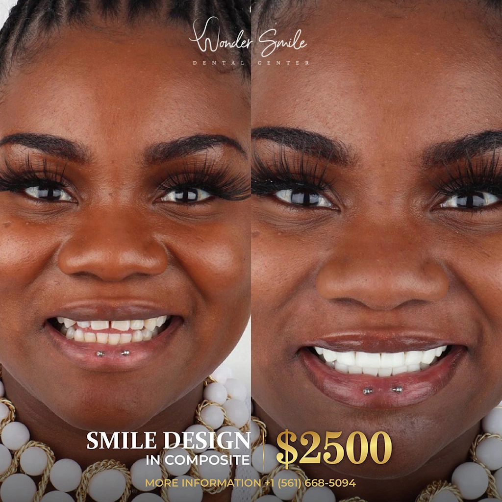 Wonder Smile By Novva Smile