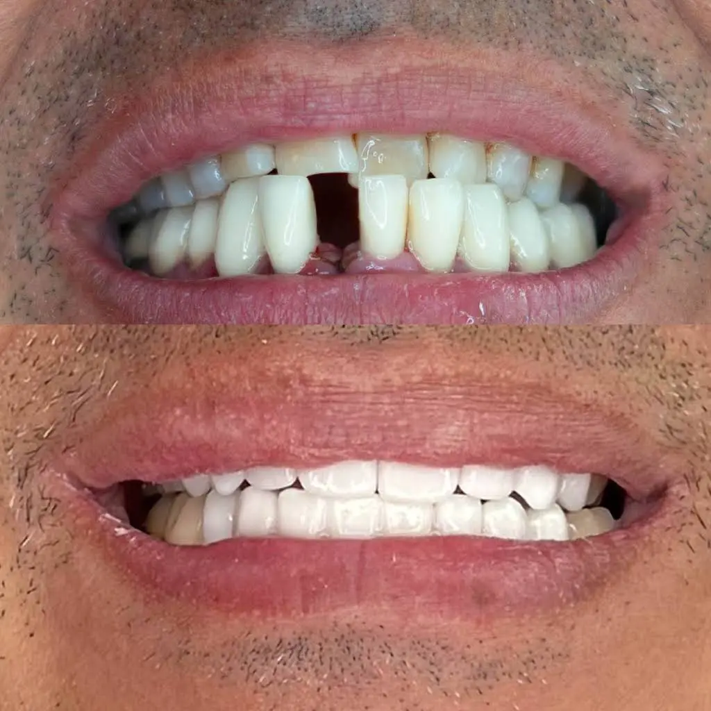 Seduction Dental Design