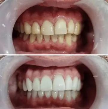 Seduction Dental Design