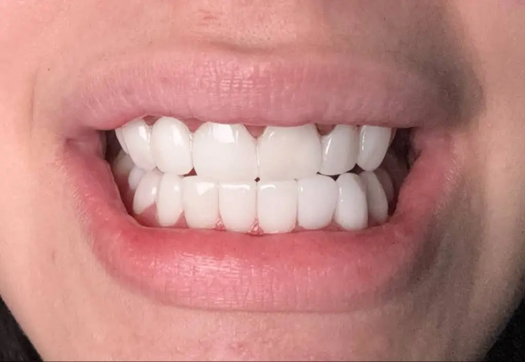 Seduction Dental Design