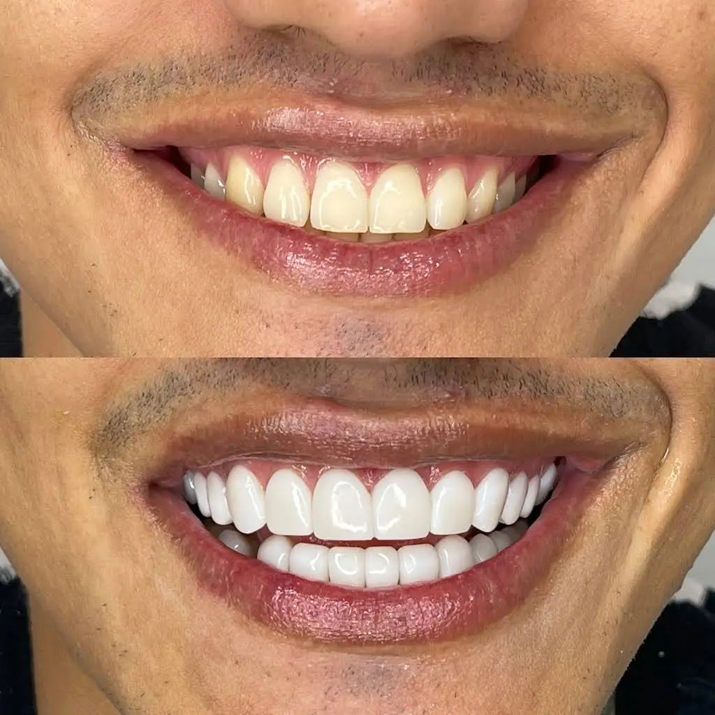Mussi King Dental