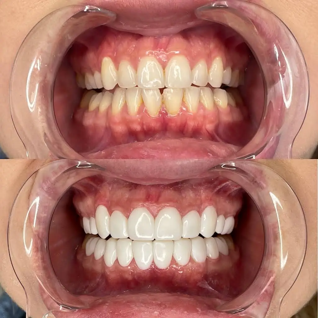 Mussi King Dental