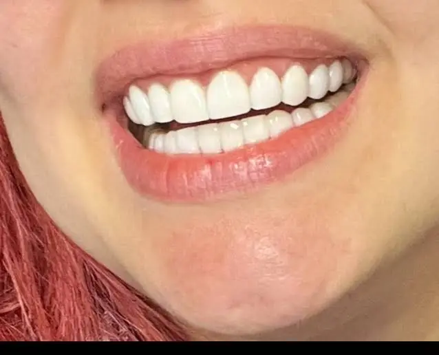 Mussi King Dental