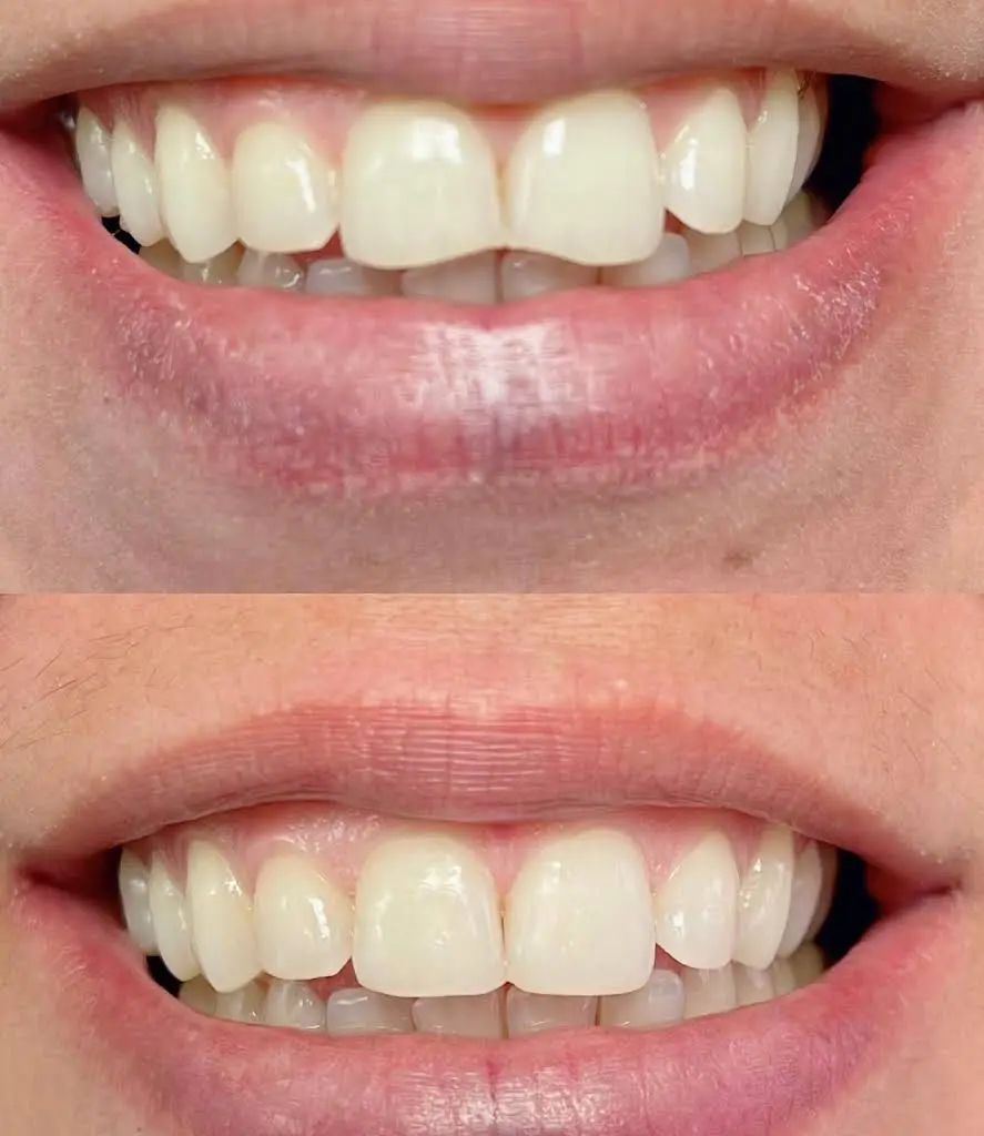 New Dental Care Corp