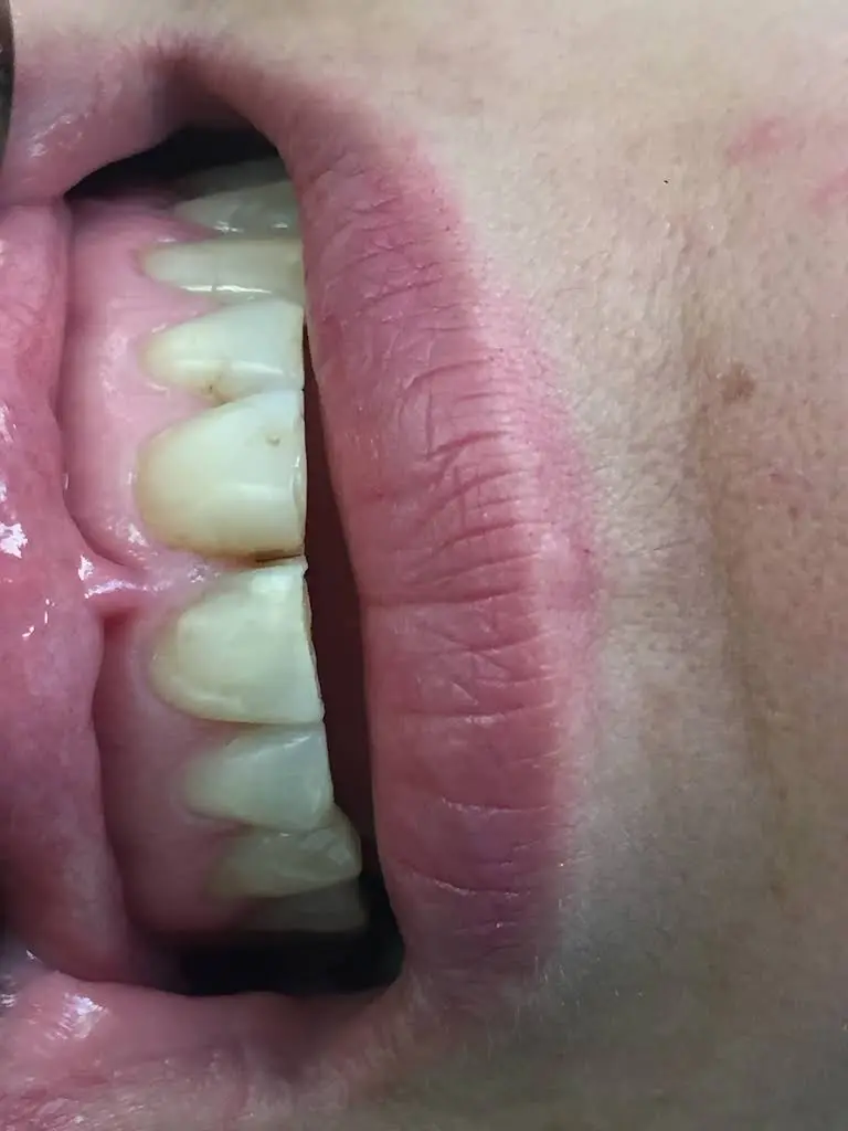 Miami Smile Institute