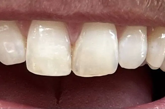 Flossy Smiles Dental Implants & Aesthetics