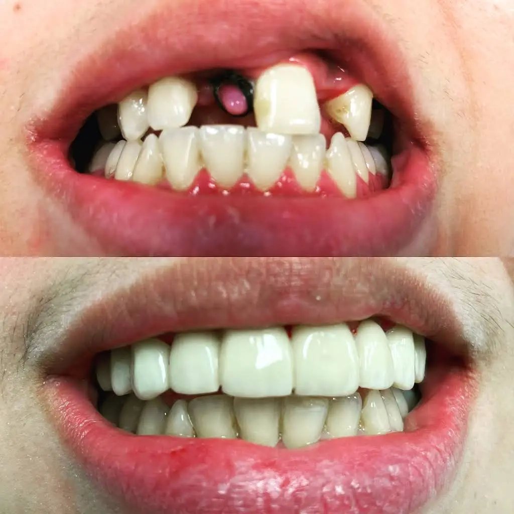 Seven Dental - Professional dental clinic exterior with modern facilities