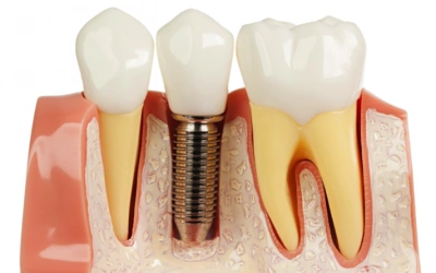 Samar Dental Group
