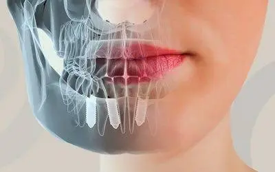 Samar Dental Group