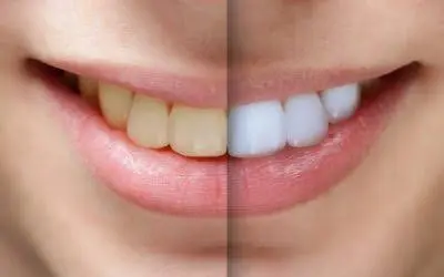 Samar Dental Group