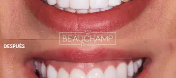 Beauchamp Dental