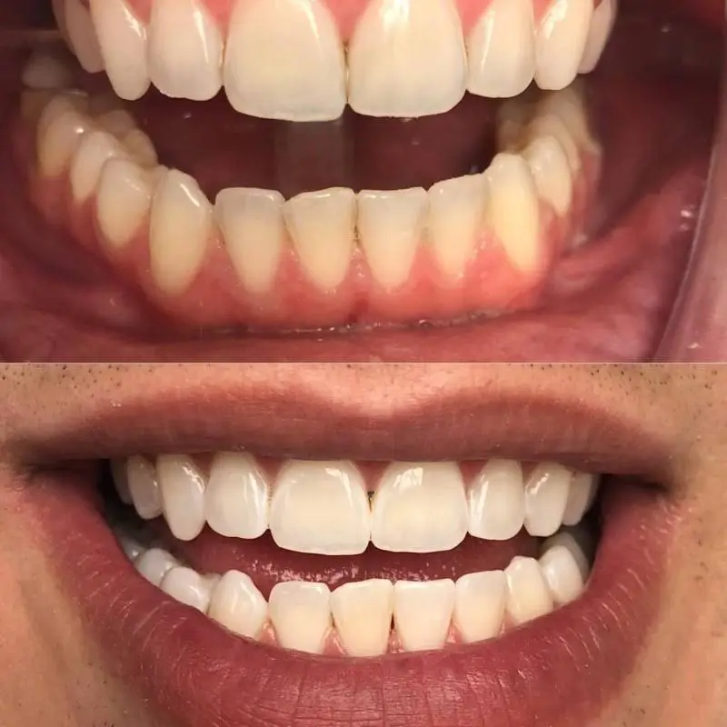 Evolution Smiles