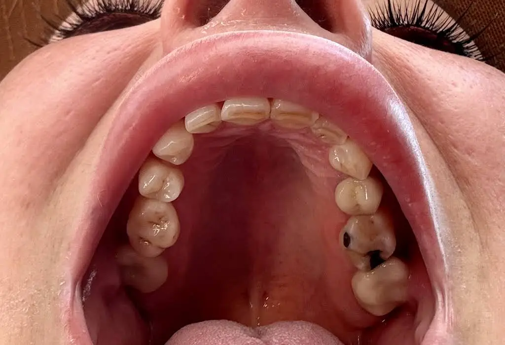 CG Smile