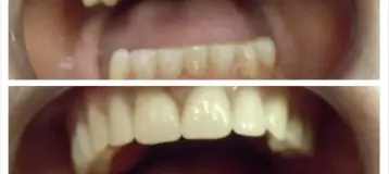 BL Dental Miami