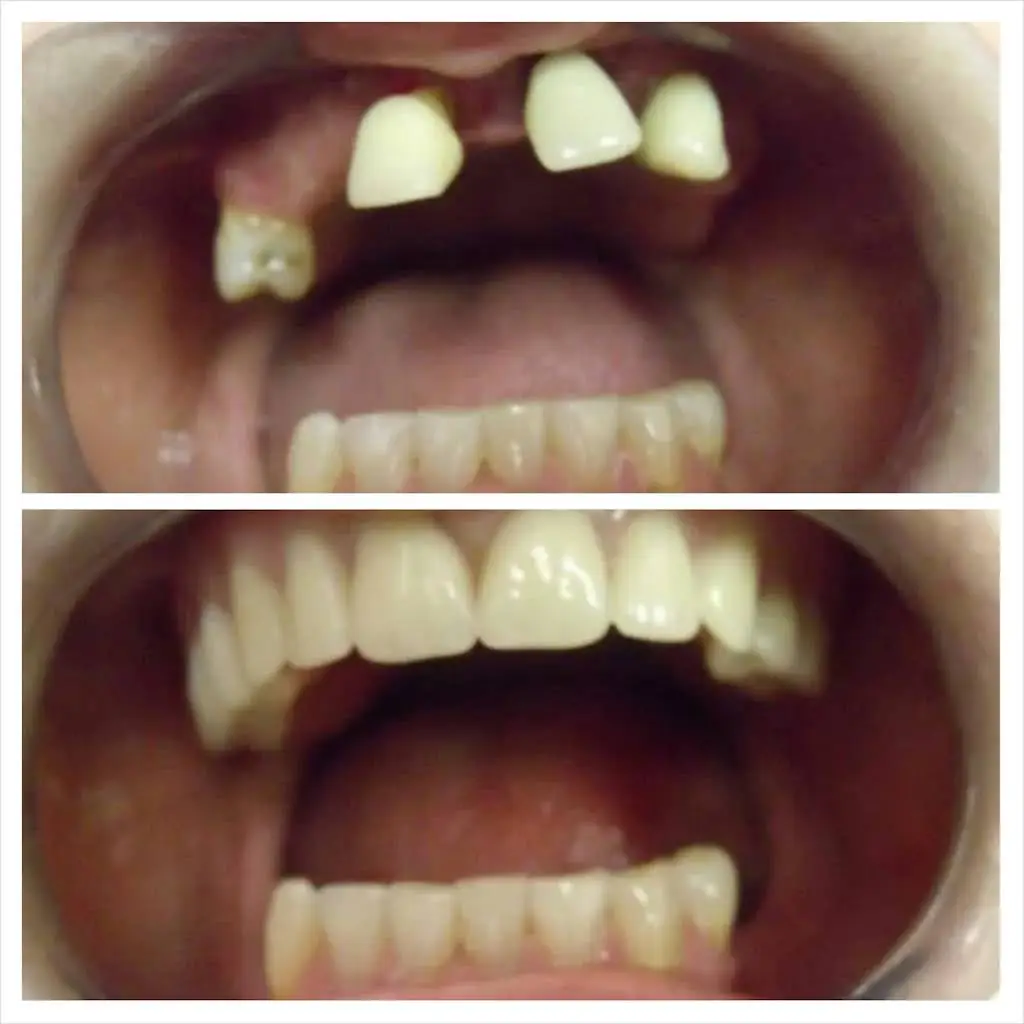 BL Dental Miami - Professional dental clinic exterior with modern facilities
