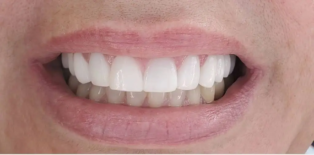 BL Dental Miami