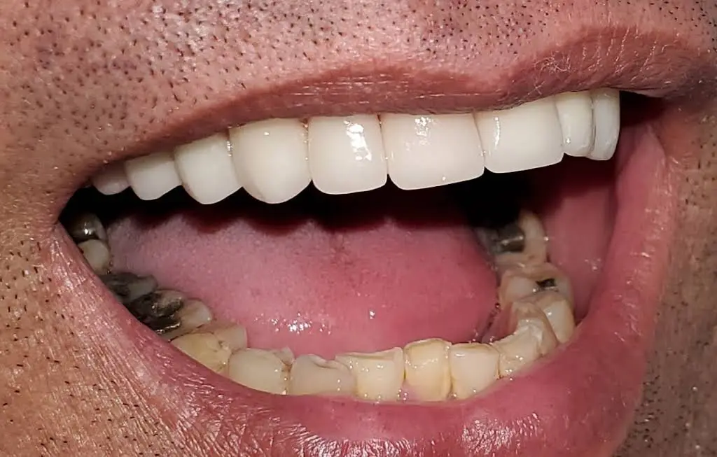 BL Dental Miami