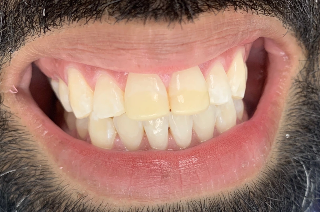 Implant Center of Coral Gables