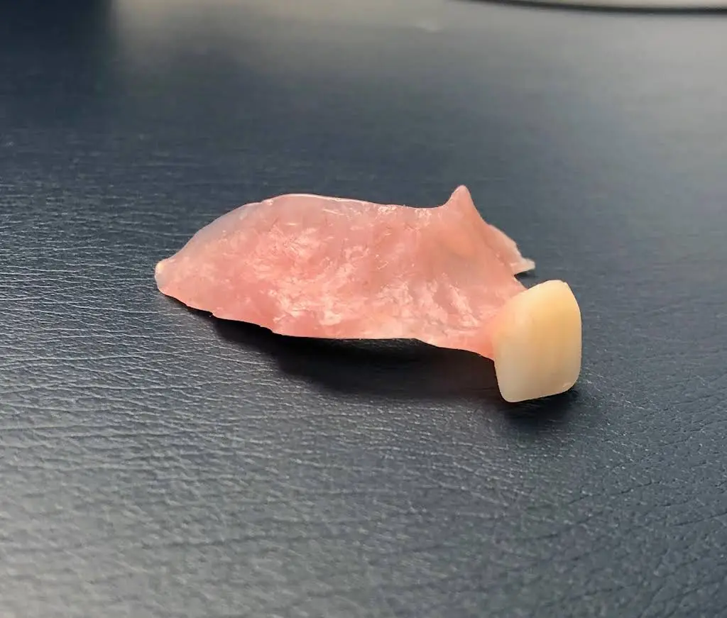 Implant Center of Coral Gables