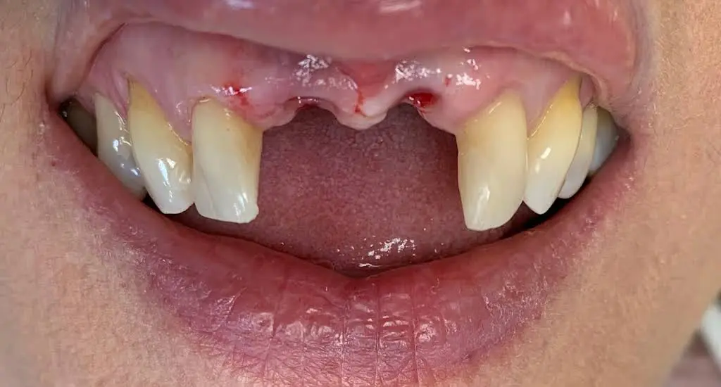 Implant Center of Coral Gables
