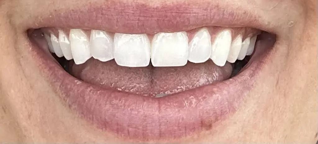 Vida Dental Coral Gables