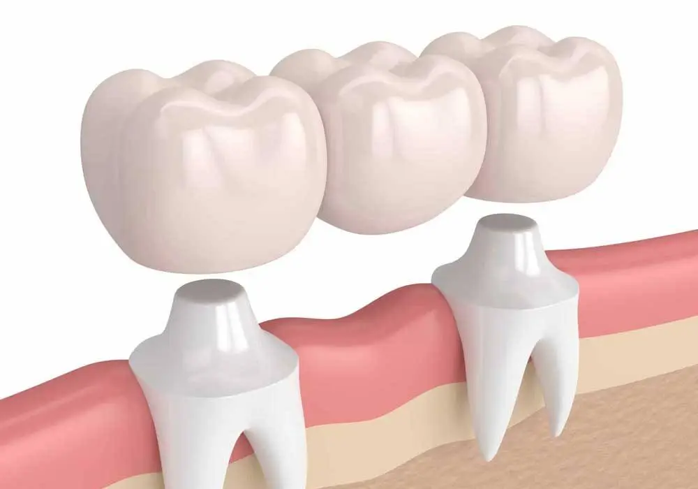 Vida Dental