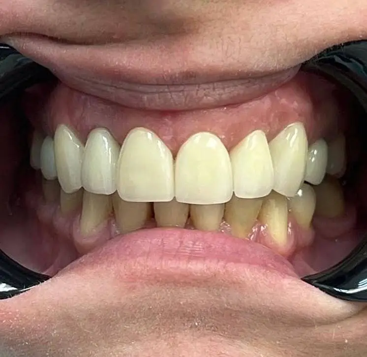 Pina Family Dental