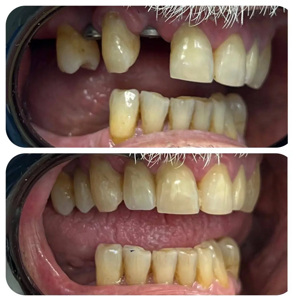 Pina Family Dental