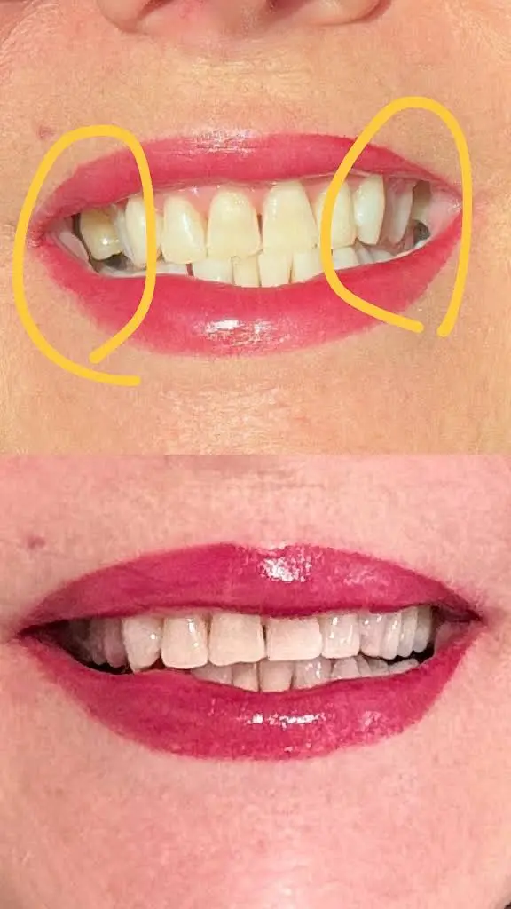Glow Dent Doral