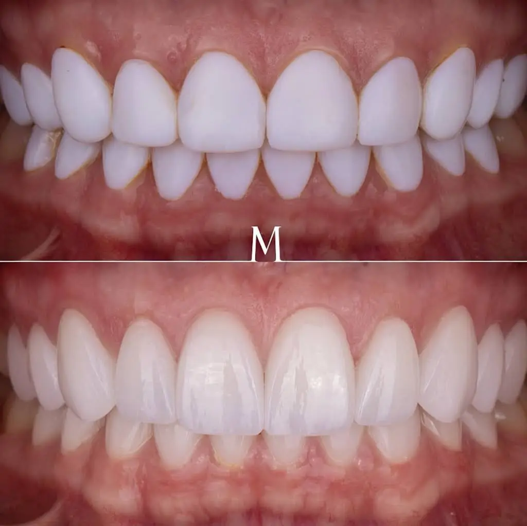 DrGSmile Smile Studio Associate Dentistry of Doral