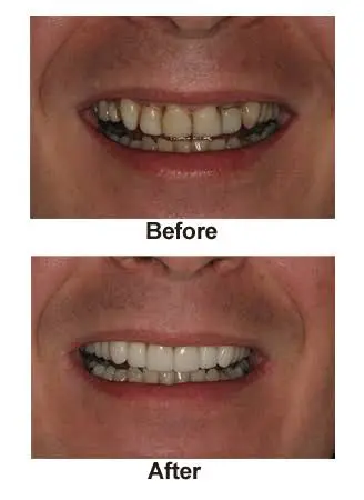 Sierra Dental
