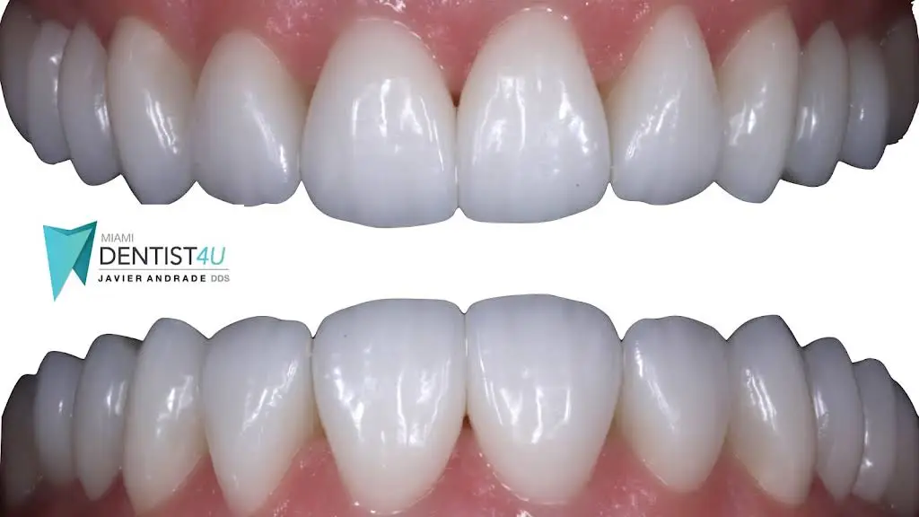 Miamidentist4u by Javier Andrade DDS