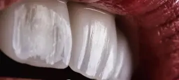 Smiling Dental Studio