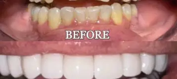 Vasallo Dental Office PA