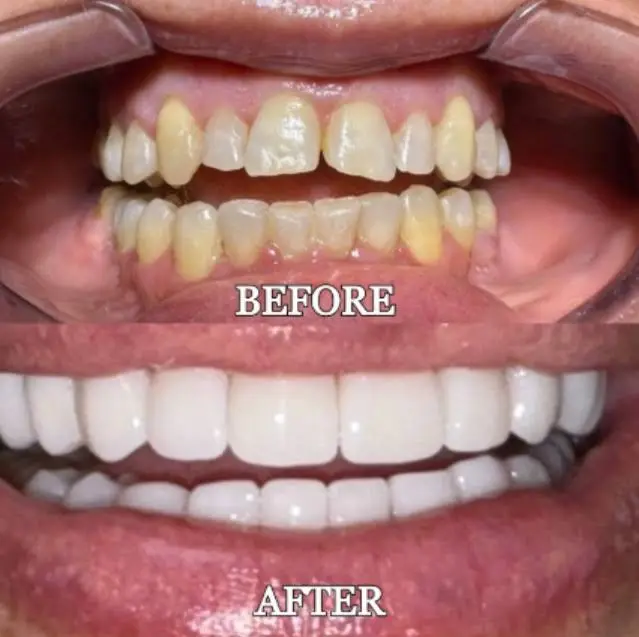 Vasallo Dental Office PA - Professional dental clinic exterior with modern facilities