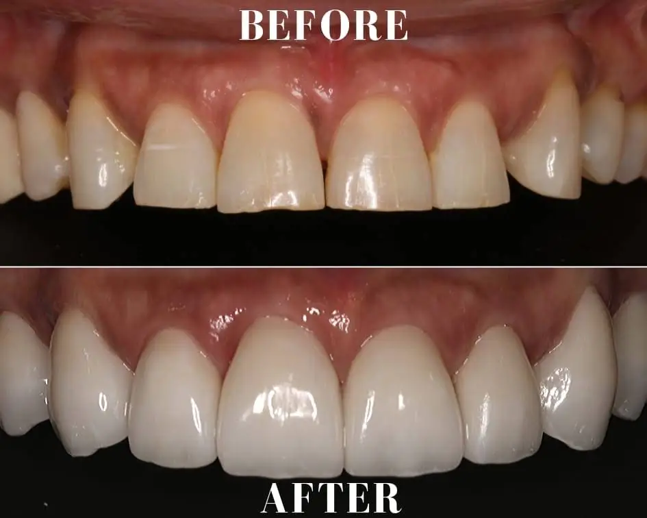 Vasallo Dental Office PA