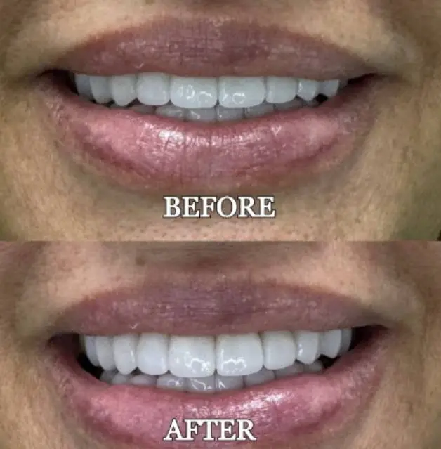 Vasallo Dental Office PA