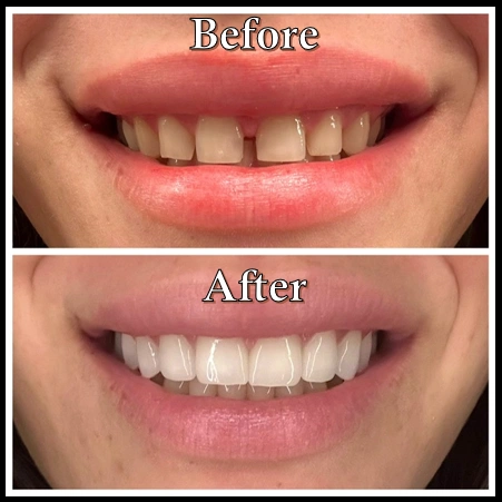 Vasallo Dental Office PA