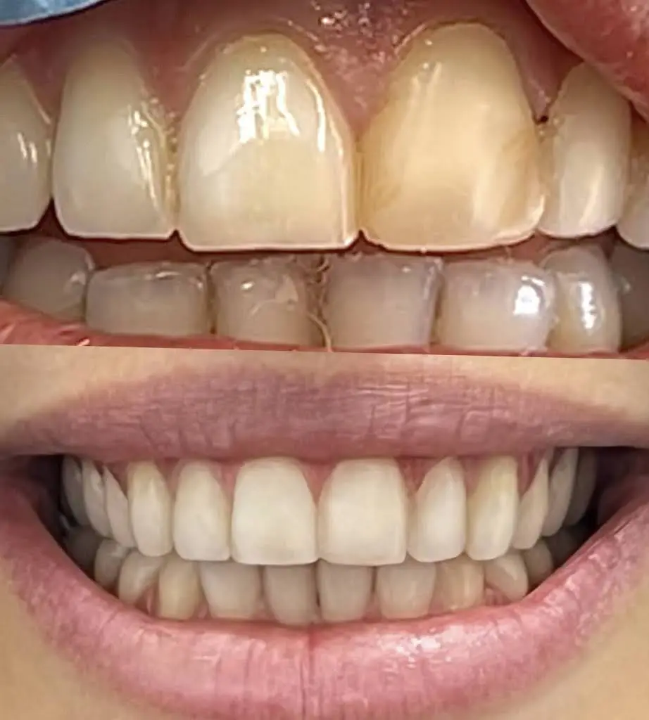 Merrick Dental Coral Gables