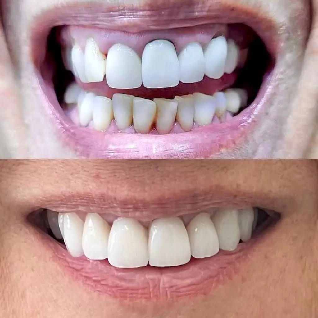 Merrick Dental Coral Gables