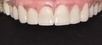 Miracle Smile Dentistry