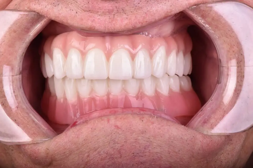 Miracle Smile Dentistry