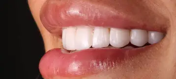 Riera Family Dental