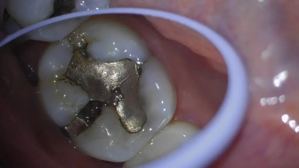 Healthy Smile Dental Care- Dr. Judex Ramirez