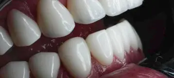 Dental Design Smile