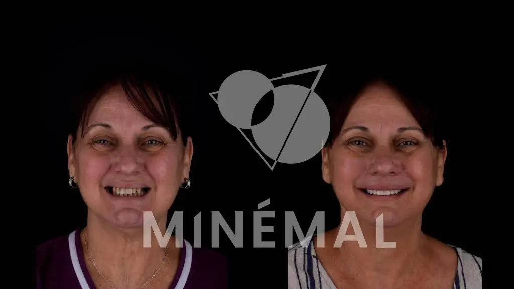 MINÉMAL DENTAL