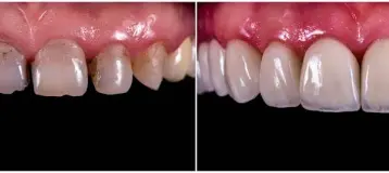 Perfect Smile Dental Centers