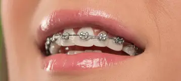 Smile Dental Center Miami
