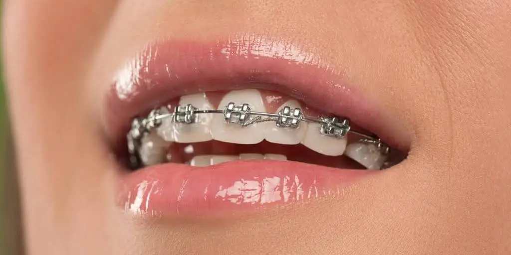 Smile Dental Center Miami - Professional dental clinic exterior with modern facilities