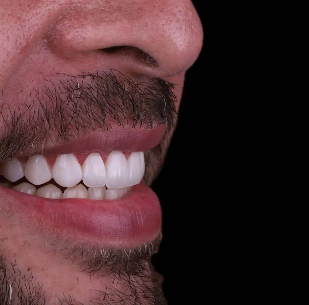 Smile Dental Center Miami